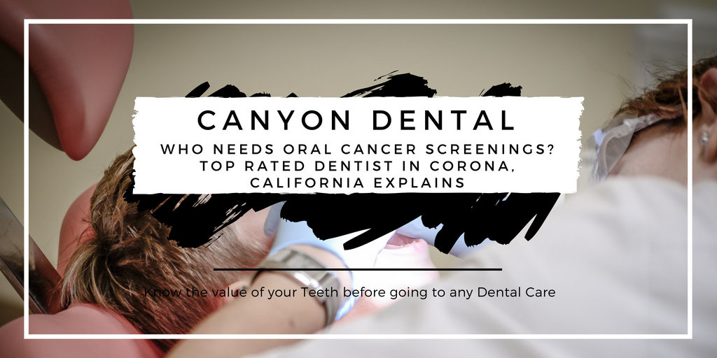 Who Needs Oral Cancer Screenings? Top Rated Dentist in Corona, California Explains