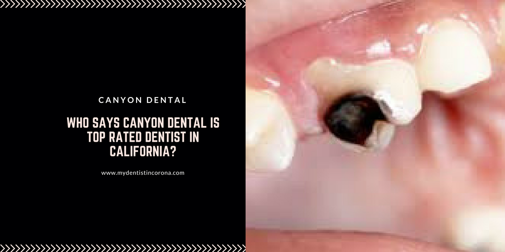 Who Says Canyon Dental is Top Rated Dentist in California?