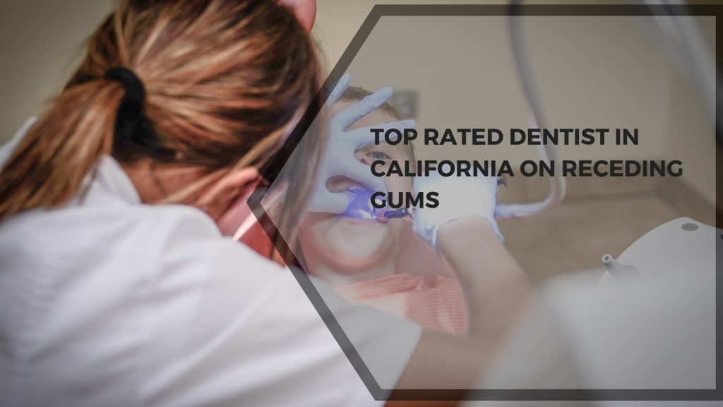 Top Rated Dentist in California on Receding Gums