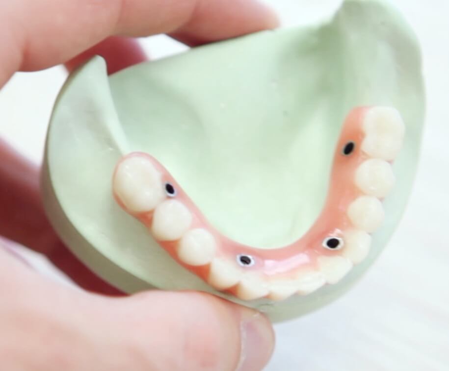 dental care of corona dentures | Corona CA